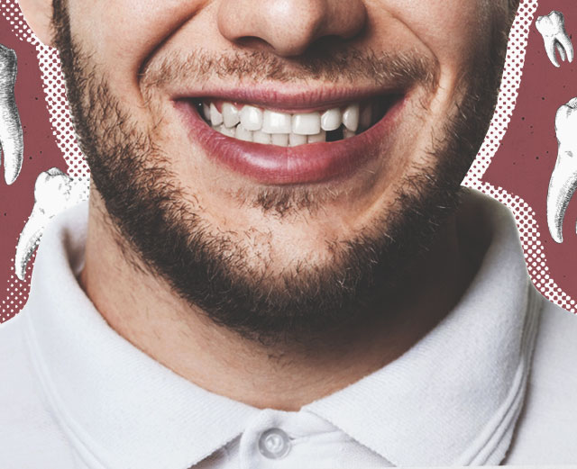Как отсутствие зубов сказывается на здоровье человека